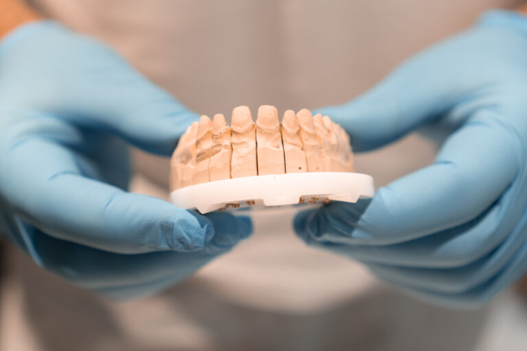 Dental restoration model showing crowns held by a dental professional