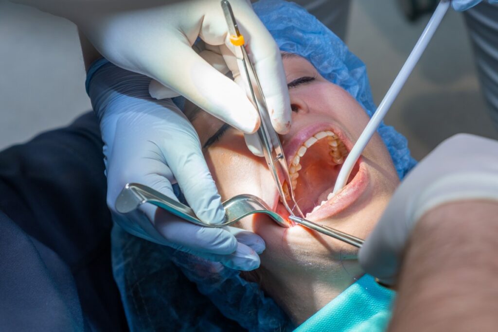 Patient undergoing a dental procedure with professional instruments