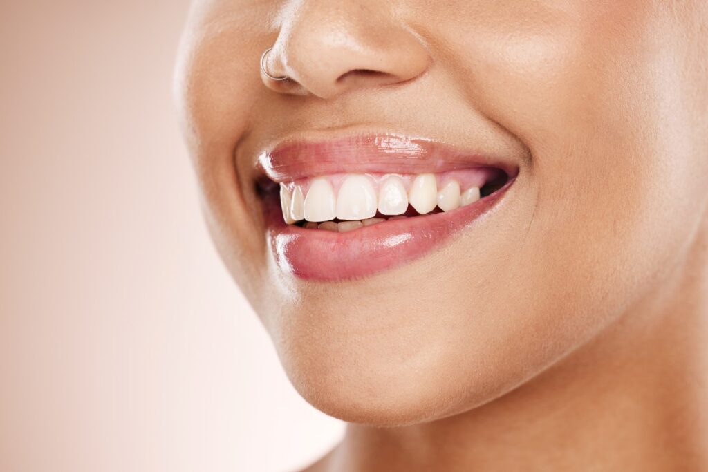 Close-up of a healthy smile with white teeth